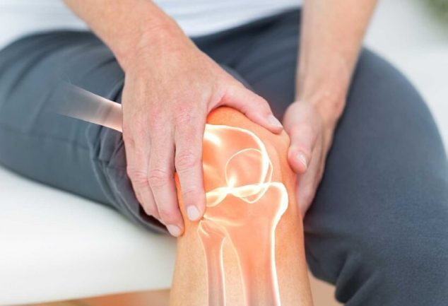 Arthritis causes, symptoms and treatment