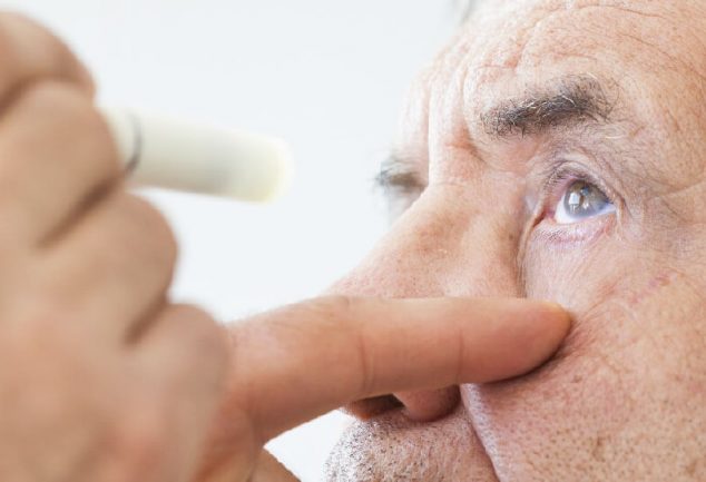Cataract causes, symptoms and treatment